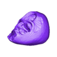 STL00005.stl 3D Model of Human Heart with Common Arterial Trunk (CAT) - generated from real patient