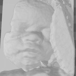 03.png STL file real baby fetus ultrassound・Design to download and 3D print