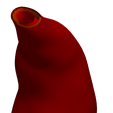 5.png Model of an abdominal aortic aneurysm from a real patient