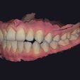 22.jpg Set of dental models for study