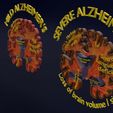 ps24.jpg Alzheimer Disease Brain coronal slice