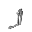 Both_bone_malunion_sag_50_degrees.png Entire collection of simulated forarm angulated malunions