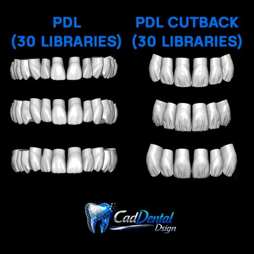 🦷 PDL&PDL CUTBACK FULL EXOCAD LIBRARIES 2026/PDL&PDL CUTBACK FULL ...