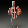 renal-cell-carcinoma-3d-model-71489c152f.jpg Renal cell carcinoma 3D model