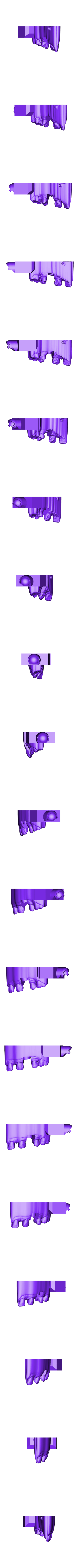 Sectioned_UpperJaw.stl Modello digitale di impianto con tessuti molli
