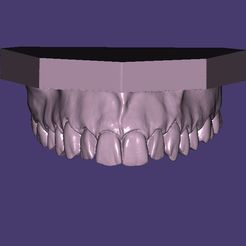 Capture-1.jpg STL file Dental Model Demonstrative・3D print design to download