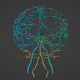 19.png 3D Model of Brain and Aneurysm