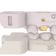 Screenshot_9.png Digital Quadrant Model with 3Shape Articulator Interfaces
