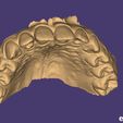 oS totir lg OH PTF Tart) Vista lett L- “hd i T+ @xOCad ss: SUPERIOR MAXILLARY from Intraoral Scan - AREA3D- Patient A. TOP DENTURE