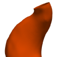 3.png Model of an abdominal aortic aneurysm from a real patient