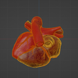 uv3.png 3D Model of Heart with Atrial Septal Defect