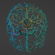 24.png 3D Model of Brain and Aneurysm
