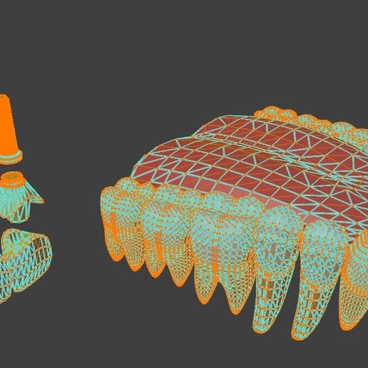 02.jpg 3D-Modell von Zahnimplantaten - Dentalmodell