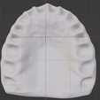 teeth,-dental,-habit-breaker,-appliance,-habit-breaking,-orthodontics,-oral,-canines,-premolar,-mola.png High resolution Habit Breaker Two Dental Appliance on Upper teeth