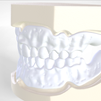 2.png Digital Try-in Full Dentures for Injection Molding