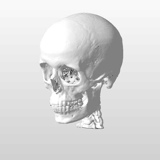 SKULL
