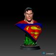 1.jpg Superman Bust - Alex Ross 3D print model