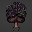 33.png 3D Model of Brain and Aneurysm