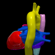 5.png Modèle 3D de la valve aortique bicuspide (BAV)