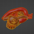 uv5.png 3D Model of Heart with Atrial Septal Defect
