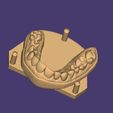 Clipboard-2024-08-24-14-44-48.jpg DIGITAL BRUXISM TRAY/SPLINT - 3 stl files (tray+model+antagonist)