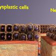 4225.jpg adaptation epithelial cell changes normal to cancer Low-poly 3D model
