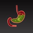 stomach3.jpg 胃