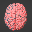 5.png 3D Model of Brain and Aneurysm