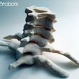 cervical063n.jpg 3D printed Cervical Spine