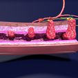 image-1.jpg 3D Colon cancer staging detail labelled