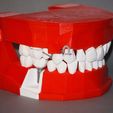 Modele_final_2_upload.jpg Dental Demonstration Model / Modèle de démonstration dentaire