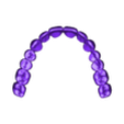 789513050_20240910_1101_Tech_01_-_H_total_B3_prerabka_0.stl DIGITAL TOTAL UPPER REMOVABLE DENTURE - 3 stl files (base + teeth + monoblock)