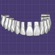 Dentes-Maxila-Robtoly-Unique-Exocad.jpg Teeth Upper Jaw - Exocad - Robtoly-Unique