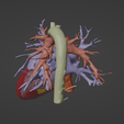 10.png 3D Model of Heart (from real patient)