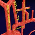 PS0087.jpg Human arterial system schematic 3D