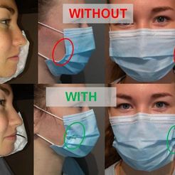 00.JPG Surgical mask retractor / Ecarteur de masque chirurgical