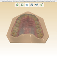 Screenshot_5.png STL file Digital Orthodontic Study Models with Virtual Bases・3D printing idea to download