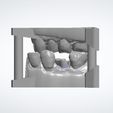 Clipboard-2024-06-11-14-39-27.jpg 10 DENTAL STUDY MODELS - REAL PATIENTS, UPPER AND LOWER 3D MODELS WITH ADDITIONAL DIES