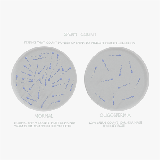 🧬 Sperm Count - Normal vs Oligospermia・ 3D File for ・Cults