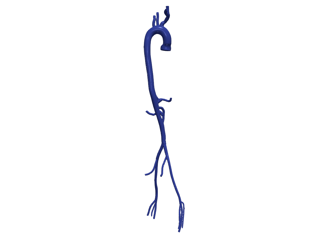 Obj File 3d Model Of Aorta And Femoral Arteries・model To Download And 