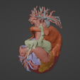 4.png 3D Model of Human Heart with Mirror Dextrocentric - generated from real patient