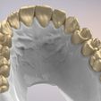 28.jpg 3D Dental Jaws Replica with Detachable Teeth