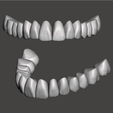 Model-H.png Aesthetic Tooth Libraries