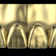 previewV3a.png All Collection For exocad