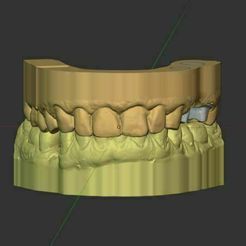 Captureb.jpg Dental Models DIES B4D