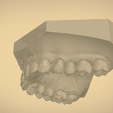 Screenshot_10.png Digital Orthodontic Study Models with Virtual Bases