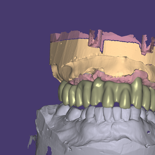 Dental arch Cad-Cam 3D model
