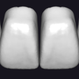 preview.png ATLANTE Library for Exocad