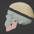 2.png 3D Model of Skull, Skull Cap and Mandible