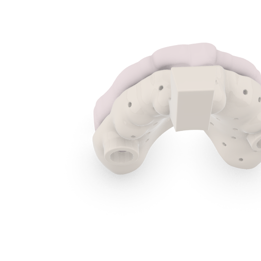 Screenshot_2.png Digital Dental Custom Impression Tray